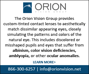 Orion Vision